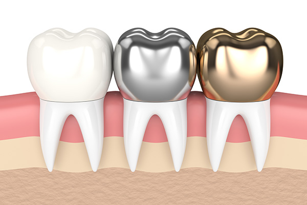 cost of dental crowns in mexico<br />
