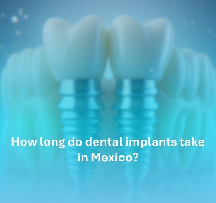 How long do dental implants take in mexico