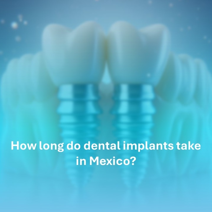 how long do dental implants take in mexico